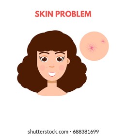 Woman with skin problem. Vector illustration