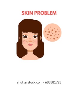 Woman with skin problem. Vector illustration