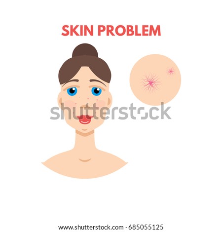 Woman with skin problem. Vector illustration