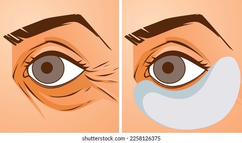 The woman with the skin problems. Wrinkles, dark circles. Under-eyes area. Under-eyes patches. Skin care, cosmetology procedure. Healthcare Illustration. Vector illustration.