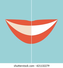 Woman smile. Teeth whitening. Dental care. Before and after view of teeth whitening