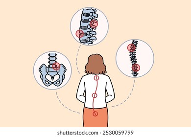 La mujer con dolor de columna se para de espaldas a la cámara y necesita ayuda de un terapeuta de masaje u osteópata. La columna vertebral dolorida de la mujer de negocios apareció como resultado de un estilo de vida sedentario y una mala silla de oficina.