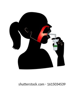 Woman With Sore Throat Using Throat Spray. Medical Illustration