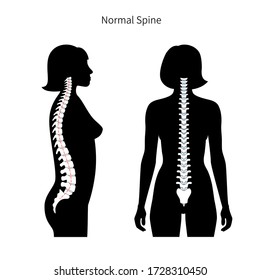 Woman spine vector illustration. Backbone and vertebral column anatomy. Scoliosis concept and symbol of spinal surgery. Back view isolated. Medical, educational and science banner .