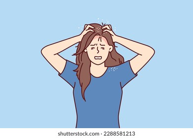 Woman suffers from itchy head after fungal infection and dandruff associated with poor-quality hair shampoo. Girl needs trip to dermatologist and use of new hygiene products or medicines for dandruff