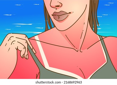 A woman with sunburn. Redness skin. Sunburn symptoms. Healthcare ilustration. Vector illustration. 