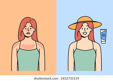 Woman with sunburn smiles after using sunscreen to protect from ultraviolet light. Girls are encouraged to use cream-gel to save themselves from summer sun, which causes sunburn on face and body