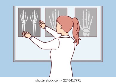 Woman surgeon applies X-ray of hand to luminous board to see sites of bone fracture in patient. Girl nurse stands with back to screen looking at images made after fracture. Flat vector design 