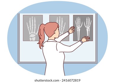 La cirujana mujer aplica rayos X de mano a la placa luminosa para ver los lugares de fractura ósea en el paciente. Niña enfermera se queda de pie en la pantalla mirando las imágenes hechas después de la fractura. Diseño vectorial plano