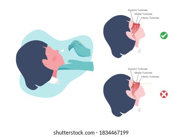 Woman taking Coronavirus (COVID 19) or DNA test by nasal (nose) swab probe. The right and wrong way nasal swab. Flat cartoon vector illustration.