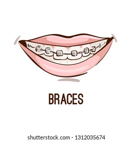 Woman teeth and smile. Close up, half with braces.  Hand drawn vector illustration. 