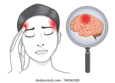 Woman touch her head because headaches symptom. Brain check with magnifying glass. Illustration about medical diagnosis .
