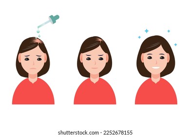 La mujer trata el vector de pérdida de cabello aislado en el fondo blanco. Antes y después de aumentar la densidad, pérdida, caída, falta de pelo, alopecia y rescate de calvicie con tratamiento. Ilustración del concepto de cuidado del pelo.