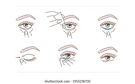 Woman Using Eye Drops Bottle. Instruction how to Correctly  Applying Eyedrops. Ophthalmology Healthcare against Redness, Allergy, Dry Eyes. Flat Line Vector Illustration and Icons set.