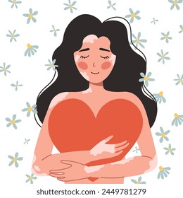 Mujer con vitíligo, positividad corporal, amor propio. Una mujer abraza un gran corazón. Ilustración vectorial