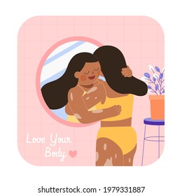 Woman With Vitiligo Hugging Herself From The Mirror. Flat Illustration, Concept Of World Vitiligo Day And Body Positivity.