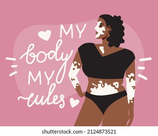 Mujer con vitiligo y mandar a mi cuerpo mis reglas. Ilustración de material vectorial plano. Enfermedad de disección. Aspecto natural de la persona con vitiligo. Letras motivadoras. Concepto de aceptación del cuerpo