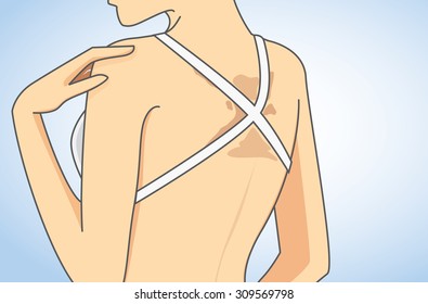 Woman wearing bikini has skin discoloration in back in close up illustration
