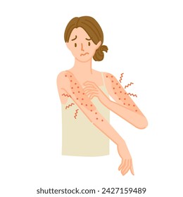 A woman whose arm skin is rough, inflamed, and itchy due to an allergic reaction.