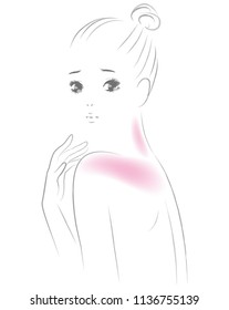 A woman whose back is a sunburn