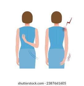 A woman whose hands cannot move behind her back due to frozen shoulders and periarthritis.