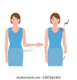 A woman whose shoulder hurts due to frozen shoulder and periarthritis and cannot open her hand to the side.