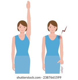 A woman whose shoulder hurts due to frozen shoulder and periarthritis and cannot lift her hand up.