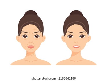 Woman with Wrinkles on Face. Wrinkles on Forehead, near Eyes, Mouth and Neck. Treatment. Before After. Lady with a Smile and Smooth Skin. Color Cartoon style. White background. Vector illustration. - Shutterstock ID 2183641189