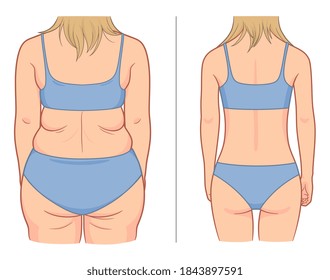 Woman's back before and after weight loss. Vector illustration.