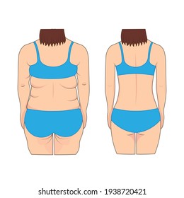 Woman's back before and after weight loss. Vector illustration.