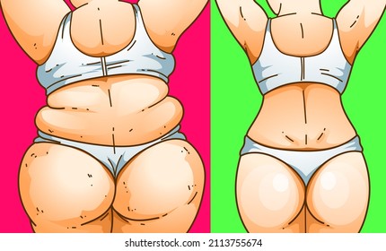 La mujer está de vuelta. Problemas enormes. Problemas de sobrepeso. Antes, después. Ilustración sanitaria. Ilustración del vector