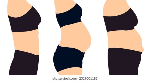 Womans Belly Tummy Tuck flabby skin Female Body Abdomen. Alcohol Hormonal Stressed Mommy Apron Sagging protruding superficial tummy Demonstrating Liposuction. Diet Weight Loss Fat Belly slim stomach