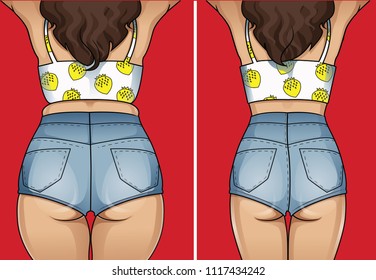 Woman's body before and after weight loss.
