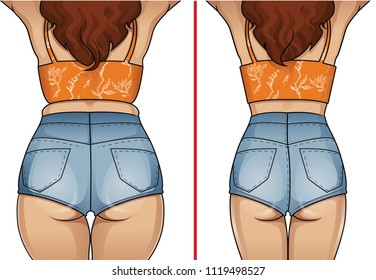 El cuerpo de la mujer antes y después de la pérdida de peso.