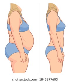 Woman's body before and after weight loss. Vector illustration.