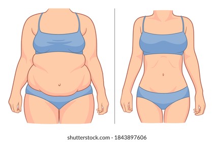 Woman's body before and after weight loss. Vector illustration.