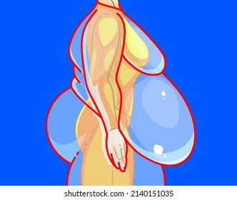 A woman's body with belly fat. Before, after. Healthcare illustration. Vector illustration.