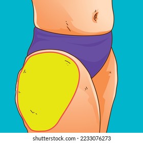 https://image.shutterstock.com/image-vector/womans-body-fat-problem-zone-260nw-2233076273.jpg