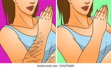 A woman's body with health problems. Hirsutism. Before, after. Medical illustration. Vector illustration.