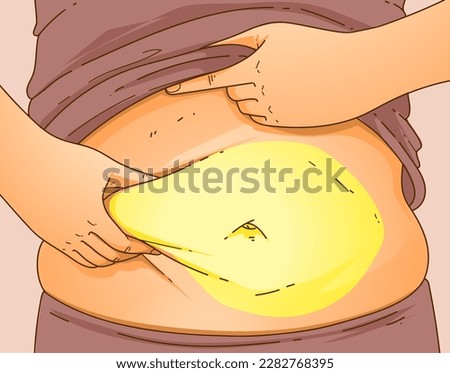 A woman's body with problem areas. Belly fat. Medical infographic. Healthcare illustration. Vector illustration. 