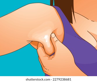 A woman's body with problem areas. Bra bulge. Medical infographic. Healthcare illustration. Vector illustration. 
