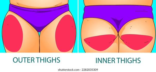 A woman's body with problem areas. Medical infographic. Healthcare illustration. Vector illustration. 