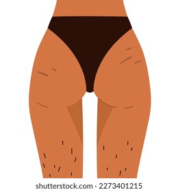 Woman's buttocks with stretch marks and hairy legs. Body positive, normalize female body hair, body care. Vector illustration in cartoon style. Isolated white background.