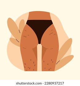 Woman's buttocks with stretch marks and hairy legs. Body positive,  love yourself, normalize female body hair, body care. Vector illustration in cartoon style. Isolated white background.