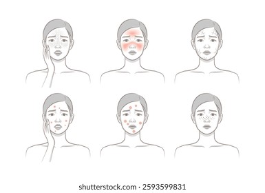 Woman's cosmetic skin trouble_Female character with freckle, blush, dryness, papule, pastule, blackhead