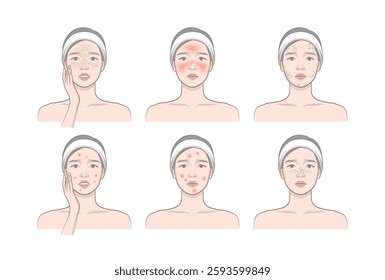 Woman's cosmetic skin trouble_Female character with freckle, blush, dryness, papule, pastule, blackhead