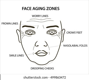 Woman's face aging zones: worry lines, nasolabial folds, crow's feet, drooping chin Wrinkles on face. 