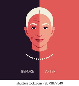 Woman's face before and after rejuvenation and plastic surgery. Anti-aging and beauty treatment. Portrait of beautiful elderly woman. Process of ageing. Comparison. Dermatology. Vector flat illustrati