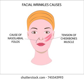 Woman's face, demonstrating causes of facial wrinkles and folds