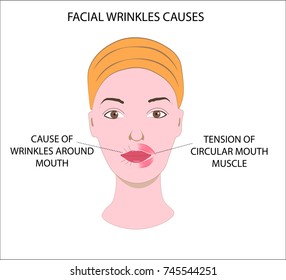 Woman's face, demonstrating causes of facial wrinkles and folds